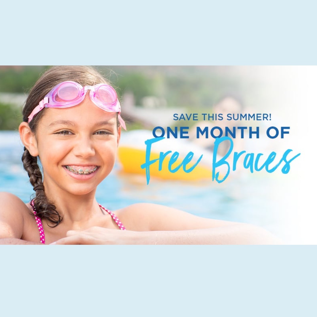 Bracespromo